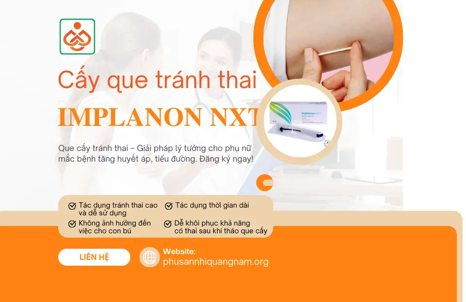 Que cấy tránh thai Implanon NXT